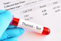 Blood sample tube with normal thyroid hormone test result